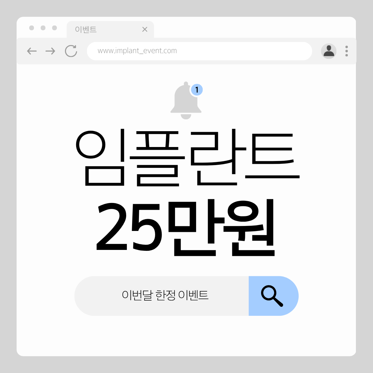 광흥창역 임플란트 싼곳 추천