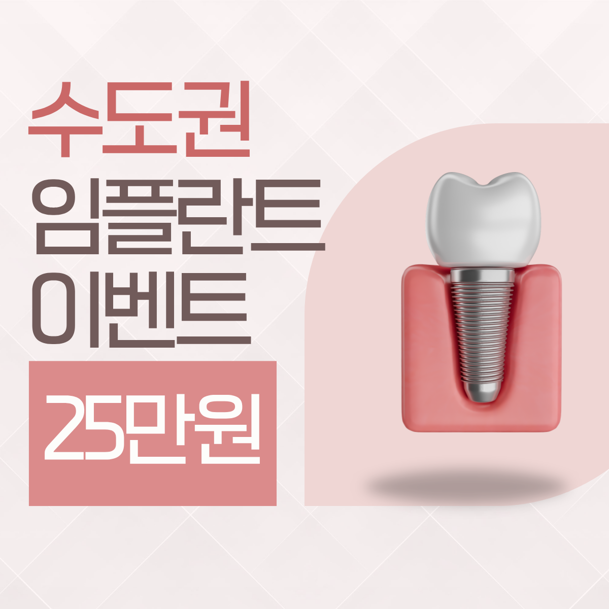 가좌역 임플란트 싼곳 추천